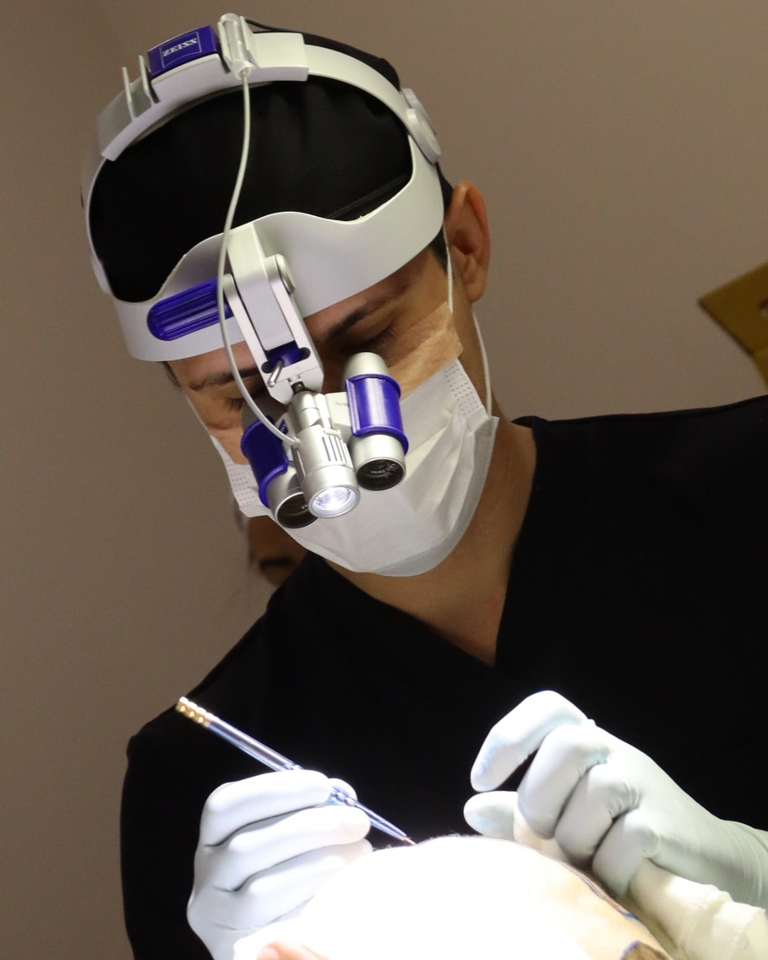 Dr. Ícaro Queiroz operando com lupa de magnificação, durante um Transplante Capilar